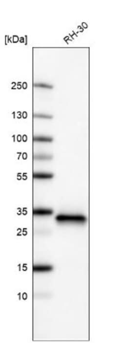 CDK4 Antibody (CL8102), Novus Biologicals 100 &mu;L | Buy Online | Novus Biologicals | Fisher Scientific